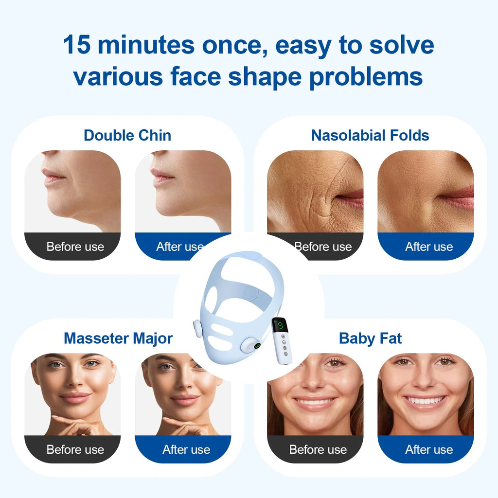V Line Face Sliming Strap Facial EMS Levage Machine Micro-courant Face Masseur Basse Fréquence Pulse Chin Cheek Lift Up Belt