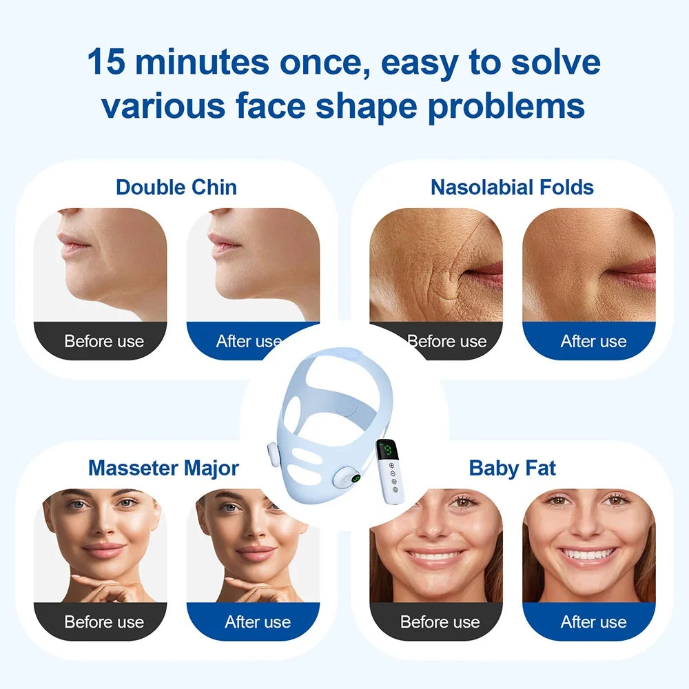 V Line Face Sliming Strap Facial EMS Levage Machine Micro-courant Face Masseur Basse Fréquence Pulse Chin Cheek Lift Up Belt